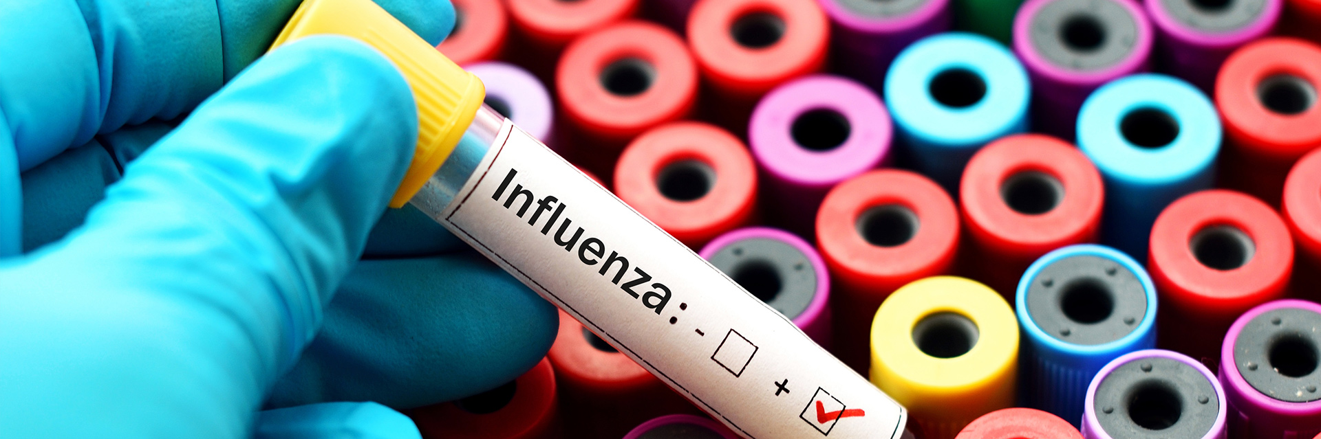 Grypa typu A/H1N1 - podstawowe informacje